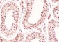 SF1 Recombinant Rabbit mAb